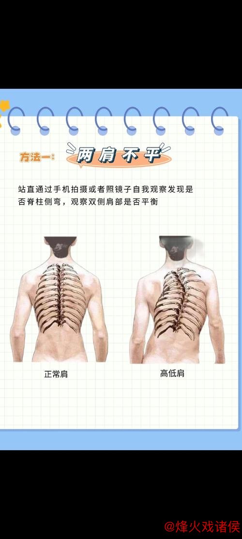 1分钟科普站丨青少年脊柱侧弯预防 这2个动作超有效 1分钟科普站丨青少年脊柱侧弯预防 这2个动作超有效